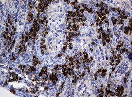 SRPRB Antibody - IHC of paraffin-embedded Human lymph node tissue using anti-SRPRB mouse monoclonal antibody.