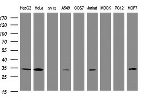 SRPRB Antibody - Western blot of extracts (35 ug) from 9 different cell lines by using g anti-SRPRB monoclonal antibody (HepG2: human; HeLa: human; SVT2: mouse; A549: human; COS7: monkey; Jurkat: human; MDCK: canine; PC12: rat; MCF7: human).