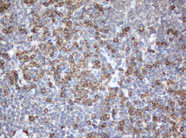 SRPRB Antibody - IHC of paraffin-embedded Human lymphoma tissue using anti-SRPRB mouse monoclonal antibody.