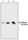 SRPRB Antibody - Western blot of SR antibody (SR beta) on 3 (1), 6 (2) and 12 (3) ng of canine microsomal protein