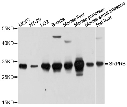 SRPRB Antibody - Western blot analysis of extracts of various cell lines, using SRPRB antibody at 1:1000 dilution. The secondary antibody used was an HRP Goat Anti-Rabbit IgG (H+L) at 1:10000 dilution. Lysates were loaded 25ug per lane and 3% nonfat dry milk in TBST was used for blocking. An ECL Kit was used for detection and the exposure time was 5s.
