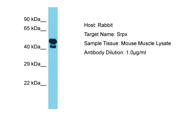 SRPX Antibody -  This image was taken for the unconjugated form of this product. Other forms have not been tested.