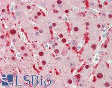 SRPX Antibody - Human Liver: Formalin-Fixed, Paraffin-Embedded (FFPE).  This image was taken for the unconjugated form of this product. Other forms have not been tested.
