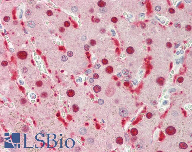 SRPX Antibody - Human Liver: Formalin-Fixed, Paraffin-Embedded (FFPE).  This image was taken for the unconjugated form of this product. Other forms have not been tested.