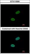SRPX Antibody - Immunofluorescence of paraformaldehyde-fixed HeLa using SRPX antibody at 1:500 dilution.