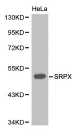 SRPX Antibody - Western blot of SRPX pAb in extracts from Hela cells.