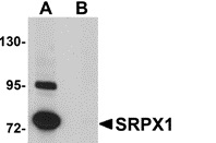 SRPX Antibody - Western blot of SK-N-SH human neuroblastoma cell lysate probed with Rabbit anti-Human SRPX1