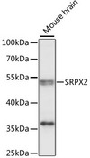 SRPX2 Antibody - Western blot analysis of extracts of mouse brain, using SRPX2 antibody at 1:1000 dilution. The secondary antibody used was an HRP Goat Anti-Rabbit IgG (H+L) at 1:10000 dilution. Lysates were loaded 25ug per lane and 3% nonfat dry milk in TBST was used for blocking. An ECL Kit was used for detection and the exposure time was 10s.