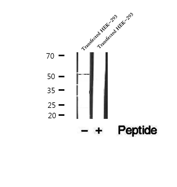 SRPX2 Antibody - Western blot analysis of extracts of human placenta tissue using SRPX2 antibody.