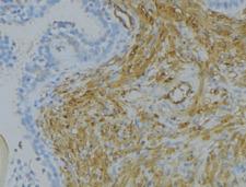 SRPX2 Antibody - 1:100 staining human uterus tissue by IHC-P. The sample was formaldehyde fixed and a heat mediated antigen retrieval step in citrate buffer was performed. The sample was then blocked and incubated with the antibody for 1.5 hours at 22°C. An HRP conjugated goat anti-rabbit antibody was used as the secondary.