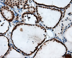 SRR / Serine Racemase Antibody - IHC of paraffin-embedded thyroid tissue using anti-SRR mouse monoclonal antibody. (Dilution 1:50).