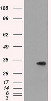 SRR / Serine Racemase Antibody - HEK293T cells were transfected with the pCMV6-ENTRY control (Left lane) or pCMV6-ENTRY SRR (Right lane) cDNA for 48 hrs and lysed. Equivalent amounts of cell lysates (5 ug per lane) were separated by SDS-PAGE and immunoblotted with anti-SRR.