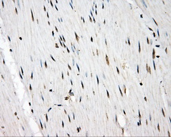 SRR / Serine Racemase Antibody - IHC of paraffin-embedded colon tissue using anti-SRR mouse monoclonal antibody. (Dilution 1:50).