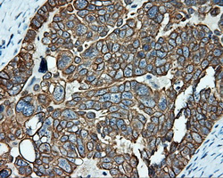 SRR / Serine Racemase Antibody - IHC of paraffin-embedded Ovary tissue using anti-SRR mouse monoclonal antibody. (Dilution 1:50).