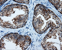 SRR / Serine Racemase Antibody - IHC of paraffin-embedded prostate tissue using anti-SRR mouse monoclonal antibody. (Dilution 1:50).