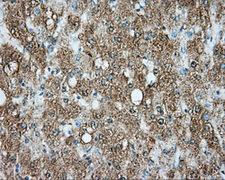 SRR / Serine Racemase Antibody - Immunohistochemical staining of paraffin-embedded liver tissue using anti-SRR mouse monoclonal antibody. (Dilution 1:50).