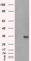 SRR / Serine Racemase Antibody - HEK293T cells were transfected with the pCMV6-ENTRY control (Left lane) or pCMV6-ENTRY SRR (Right lane) cDNA for 48 hrs and lysed. Equivalent amounts of cell lysates (5 ug per lane) were separated by SDS-PAGE and immunoblotted with anti-SRR.