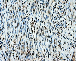 SRR / Serine Racemase Antibody - IHC of paraffin-embedded endometrium tissue using anti-SRR mouse monoclonal antibody. (Dilution 1:50).