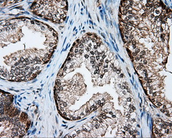 SRR / Serine Racemase Antibody - IHC of paraffin-embedded prostate tissue using anti-SRR mouse monoclonal antibody. (Dilution 1:50).
