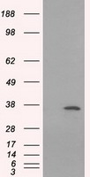 SRR / Serine Racemase Antibody - HEK293T cells were transfected with the pCMV6-ENTRY control (Left lane) or pCMV6-ENTRY SRR (Right lane) cDNA for 48 hrs and lysed. Equivalent amounts of cell lysates (5 ug per lane) were separated by SDS-PAGE and immunoblotted with anti-SRR.