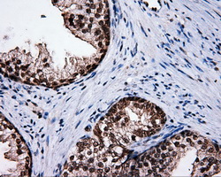 SRR / Serine Racemase Antibody - Immunohistochemical staining of paraffin-embedded prostate tissue using anti-SRR mouse monoclonal antibody. (Dilution 1:50).