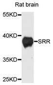 SRR / Serine Racemase Antibody - Western blot analysis of extracts of rat brain cells.
