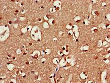 SRR / Serine Racemase Antibody - Immunohistochemistry of paraffin-embedded human brain tissue at dilution of 1:100