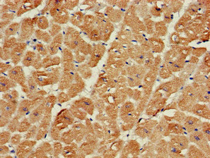 SRR / Serine Racemase Antibody - Immunohistochemistry of paraffin-embedded human heart tissue at dilution of 1:100
