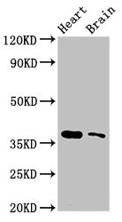 SRR / Serine Racemase Antibody - Western Blot Positive WB detected in:Mouse heart tissue,Mouse brain tissue All Lanes:SRR antibody at 3µg/ml Secondary Goat polyclonal to rabbit IgG at 1/50000 dilution Predicted band size: 37 KDa Observed band size: 37 KDa