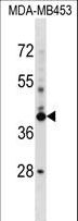 SRRD Antibody - SRRD Antibody western blot of MDA-MB453 cell line lysates (35 ug/lane). The SRRD antibody detected the SRRD protein (arrow).