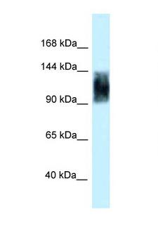 SRRM1 Antibody - Western blot of Rat Brain lysate. Anti-SRRM1 Antibody concentration 1 ug/ml.  This image was taken for the unconjugated form of this product. Other forms have not been tested.