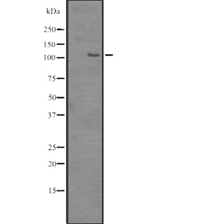 SRRM1 Antibody - Western blot analysis of SRRM1 expression in HEK293 cells. The lane on the left is treated with the antigen-specific peptide.