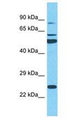 SRRM3 Antibody - SRRM3 antibody Western Blot of THP-1. Antibody dilution: 1 ug/ml.  This image was taken for the unconjugated form of this product. Other forms have not been tested.