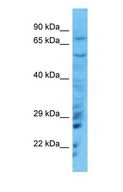 SRRM3 Antibody - Western blot of SRRM3 Antibody with human Jurkat Whole Cell lysate.  This image was taken for the unconjugated form of this product. Other forms have not been tested.