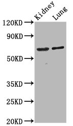 SRRM4 Antibody - Western Blot Positive WB detected in: Rat kidney tissue, Mouse lung tissue All Lanes: SRRM4 antibody at 4.2µg/ml Secondary Goat polyclonal to rabbit IgG at 1/50000 dilution Predicted band size: 69 KDa Observed band size: 69 KDa