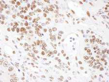 SRRT / ARS2 Antibody - Detection of mouse ARS2 by immunohistochemistry. Sample: FFPE section of mouse teratoma. Antibody: Affinity purified rabbit anti- ARS2 used at a dilution of 1:5,000 (0.2µg/ml). Detection: DAB