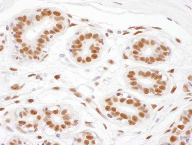 SRRT / ARS2 Antibody - Detection of human ARS2 by immunohistochemistry. Sample: FFPE section of human mammary glands. Antibody: Affinity purified rabbit anti- ARS2 used at a dilution of 1:5,000 (0.2µg/ml). Detection: DAB