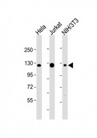 SRRT / ARS2 Antibody - All lanes: Anti-srrt Antibody (C-Term) at 1:2000 dilution. Lane 1: HeLa whole cell lysates. Lane 2: Jurkat whole cell lysates. Lane 3: NIH/3T3 whole cell lysates Lysates/proteins at 20 ug per lane. Secondary Goat Anti-Rabbit IgG, (H+L), Peroxidase conjugated at 1:10000 dilution. Predicted band size: 103 kDa. Blocking/Dilution buffer: 5% NFDM/TBST.