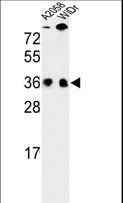 SRSF1 / SF2 Antibody - Western blot of SFRS1 Antibody in A2058, WiDr cell line lysates (35 ug/lane). SFRS1 (arrow) was detected using the purified antibody.