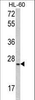 SRSF1 / SF2 Antibody - Western blot of SFRS1 Antibody in HL-60 cell line lysates (35 ug/lane). SFRS1 (arrow) was detected using the purified antibody.