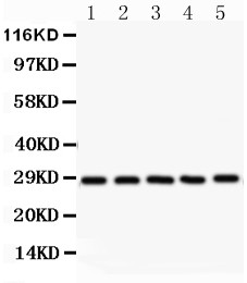 SRSF1 / SF2 Antibody - SF2 antibody Western blot. All lanes: Anti SF2 at 0.5 ug/ml. Lane 1: Rat Testis Tissue Lysate at 50 ug. Lane 2: Rat Brain Tissue Lysate at 50 ug. Lane 3: NEURO Whole Cell Lysate at 40 ug. Lane 4: 293T Whole Cell Lysate at 40 ug. Lane 5: SW620 Whole Cell Lysate at 40 ug. Predicted band size: 28 kD. Observed band size: 28 kD.