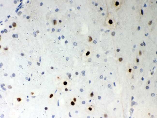 SRSF1 / SF2 Antibody - SF2 antibody IHC-paraffin: Rat Brain Tissue.