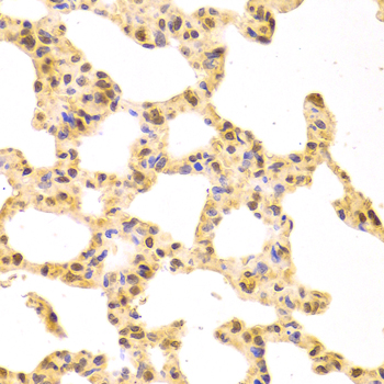SRSF1 / SF2 Antibody - Immunohistochemistry of paraffin-embedded rat lung using SRSF1 Antibodyat dilution of 1:100 (40x lens).