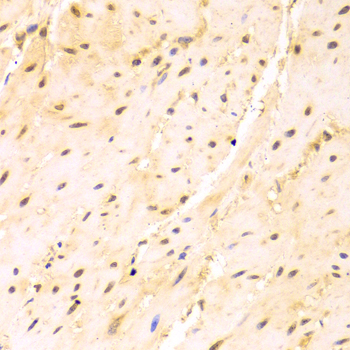 SRSF1 / SF2 Antibody - Immunohistochemistry of paraffin-embedded mouse esophagus using SRSF1 Antibodyat dilution of 1:100 (40x lens).