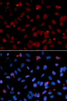 SRSF1 / SF2 Antibody - Immunofluorescence analysis of U2OS cells using SRSF1 antibody. Blue: DAPI for nuclear staining.