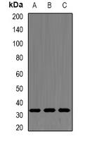 SRSF1 / SF2 Antibody - Western blot analysis of SF2 expression in MCF7 (A); A549 (B); mouse spleen (C) whole cell lysates.