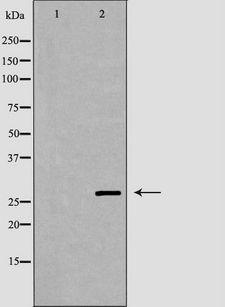 SRSF1 / SF2 Antibody - Western blot analysis of extracts of human brain tissue using SFRS1 antibody. The lane on the left is treated with the antigen-specific peptide.