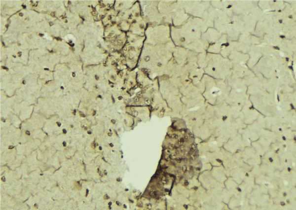 SRSF1 / SF2 Antibody - 1:100 staining mouse brain tissue by IHC-P. The sample was formaldehyde fixed and a heat mediated antigen retrieval step in citrate buffer was performed. The sample was then blocked and incubated with the antibody for 1.5 hours at 22°C. An HRP conjugated goat anti-rabbit antibody was used as the secondary.