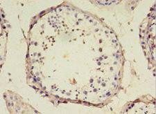 SRSF10 / FUSIP1 Antibody - Immunohistochemistry of paraffin-embedded human testis using antibody at 1:100 dilution.  This image was taken for the unconjugated form of this product. Other forms have not been tested.