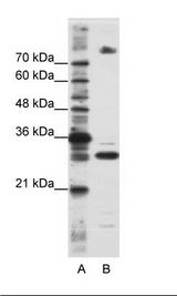 SRSF10 / FUSIP1 Antibody - A: Marker, B: HepG2 Cell Lysate.  This image was taken for the unconjugated form of this product. Other forms have not been tested.